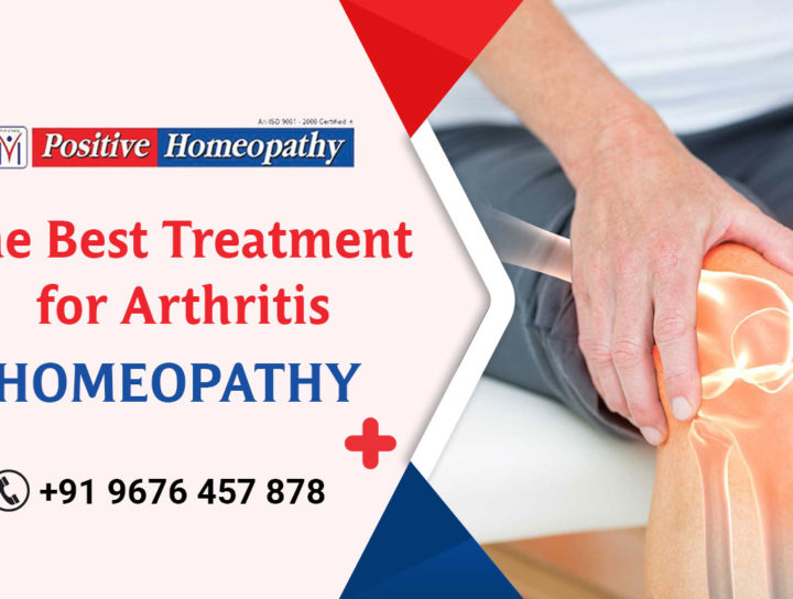 Best Treatment for Arthritis