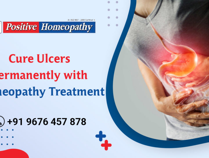 Homeopathy Treatment for Ulcers