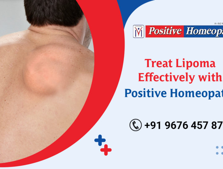 lipoma treatment in homeopathy