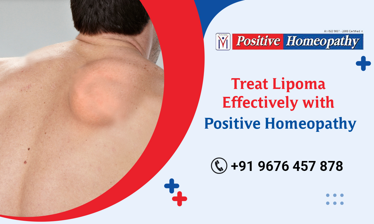 lipoma treatment in homeopathy